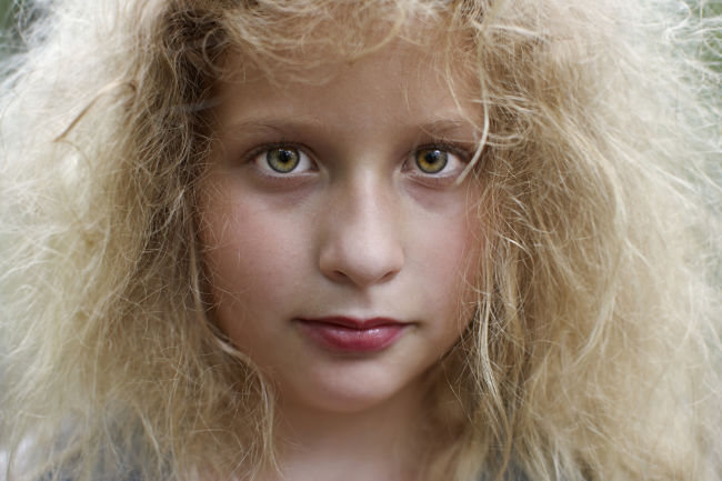 Frizzy hair is an inherited trait and so it often occurs in families that have very fine hair