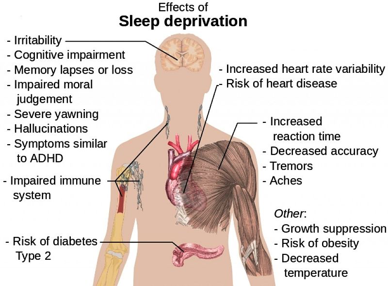 The effects of sleep deprivation