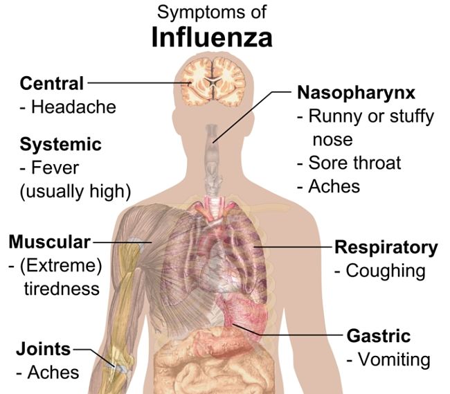 Main symptoms of influenza